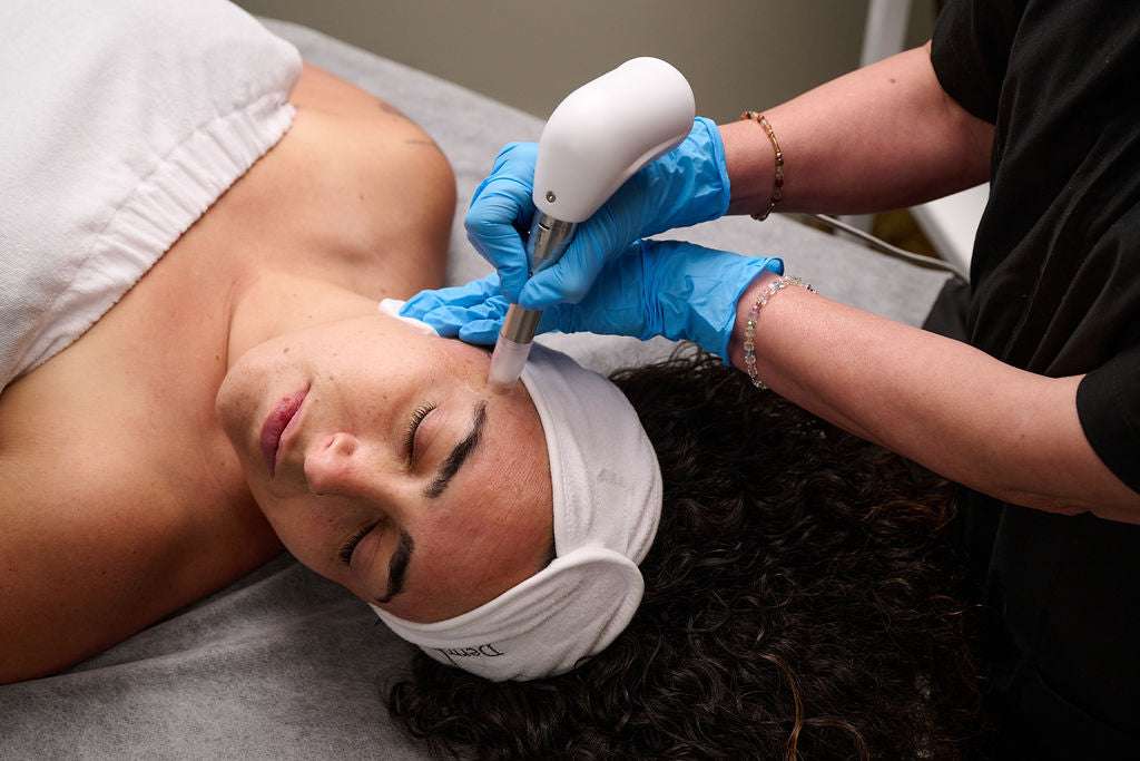 TWIST Microneedling benefits