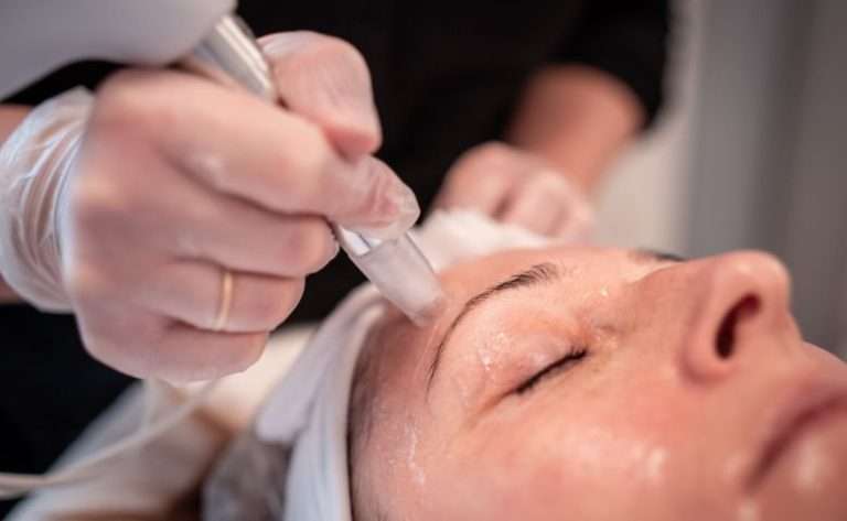 TWIST Microneedling