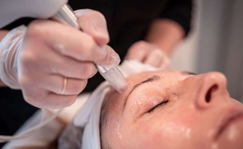 TWIST Microneedling