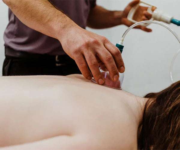 Cupping therapy