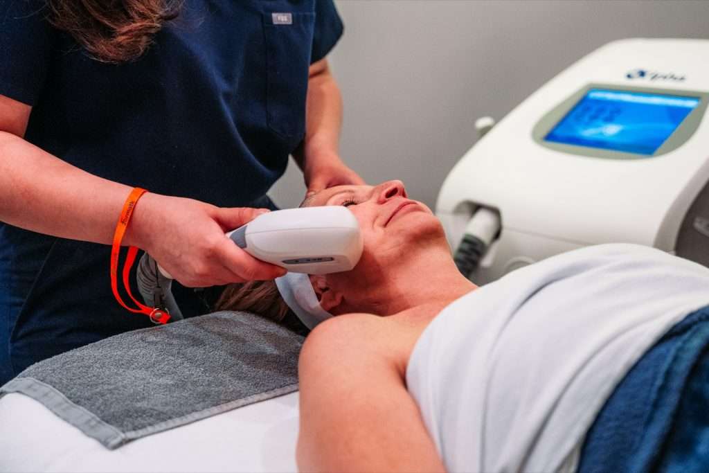 IPL Photofacial device treating a client's skin