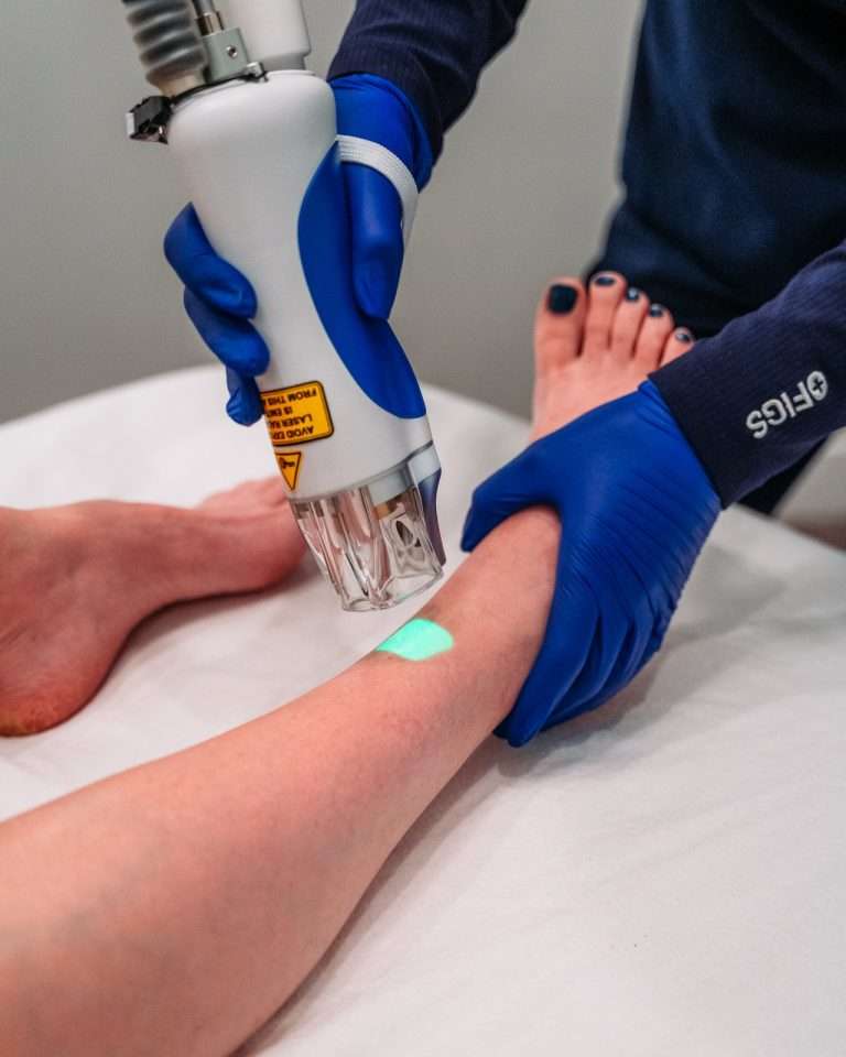 Arm laser hair removal treatment close-up